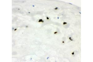 IHC analysis of CCNE1 using anti-CCNE1 antibody (ABIN7601193).