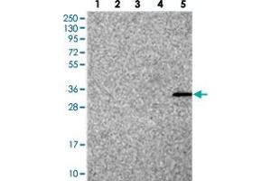 Western blot analysis of Lane 1: RT-4, Lane 2: U-251 MG, Lane 3: Human Plasma, Lane 4: Liver, Lane 5: Tonsil with FAM70B polyclonal antibody . (TMEM255B 抗体)