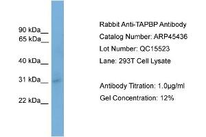 WB Suggested Anti-TAPBP  Antibody Titration: 0. (TAPBP 抗体  (N-Term))