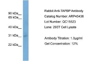 WB Suggested Anti-TAPBP  Antibody Titration: 0.