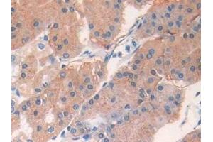 Immunohistochemistry (IHC) image for anti-Interleukin 33 (IL33) (AA 112-270) antibody (ABIN7426418)