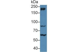 Western Blot; Sample: Mouse Cerebrum lysate; Primary Ab: 5µg/ml Rabbit Anti-Human MYH10 Antibody Second Ab: 0. (MYH10 抗体  (AA 438-716))
