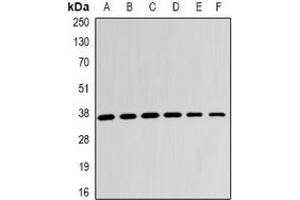 Western blot analysis of LDHB expression in A431 (A), Jurkat (B), A549 (C), mouse kidney (D), mouse lung (E), rat brain (F) whole cell lysates. (LDHB 抗体)