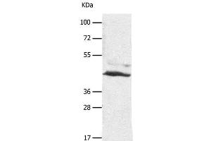 Western Blot analysis of A549 cell using SLC16A7 Polyclonal Antibody at dilution of 1:450 (SLC16A7 抗体)