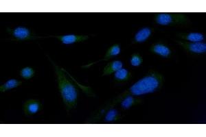IF analysis of PLCG 2/PLCG2 using anti-PLCG 2/PLCG2 antibody (ABIN5692854). (Phospholipase C gamma 2 抗体  (AA 1201-1258))