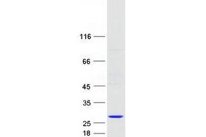 Western Blotting (WB) image for NFKB Inhibitor Interacting Ras-Like 2 (NKIRAS2) (Transcript Variant 2) protein (Myc-DYKDDDDK Tag) (ABIN2727347)