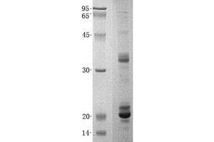 Validation with Western Blot (eIF4EBP2 Protein (His tag))