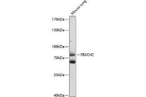 Western blot analysis of extracts of mouse lung, using FBXO42 antibody (ABIN7267092) at 1:1000 dilution. (FBXO42 抗体  (AA 468-717))