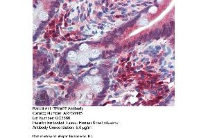 Immunohistochemistry with Human Small Intestine tissue at an antibody concentration of 5. (TRIM35 抗体  (Middle Region))