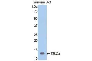 WB of Protein Standard: different control antibodies against Highly purified E. (Vitamin D-Binding Protein ELISA 试剂盒)