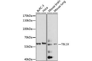 Western blot analysis of extracts of various cell lines, using TBL1X antibody. (TBL1X 抗体)