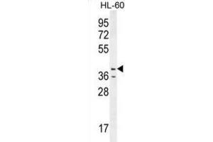 Western Blotting (WB) image for anti-Caspase 12 (Gene/pseudogene) (CASP12) antibody (ABIN2996496) (Caspase 12 抗体)