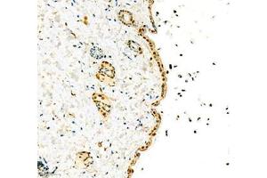 Immunohistochemistry (Paraffin-embedded Sections) (IHC (p)) image for anti-High Mobility Group Nucleosome Binding Domain 1 (HMGN1) antibody (ABIN7074222)