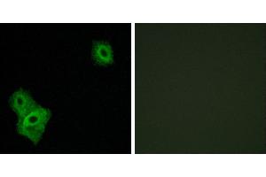 Peptide - +Immunohistochemistry analysis of paraffin-embedded human brain tissue, using AIFM3 antibody. (AIFM3 抗体)