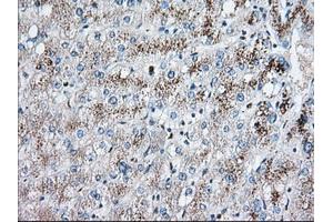 Immunohistochemical staining of paraffin-embedded Human liver tissue using anti-EIF2S1 mouse monoclonal antibody. (EIF2S1 抗体)