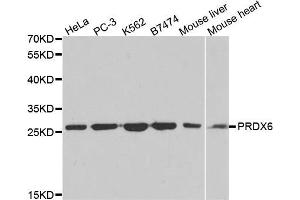 Western blot analysis of extracts of various cell lines, using PRDX6 antibody (ABIN5971063) at 1/1000 dilution. (Peroxiredoxin 6 抗体)