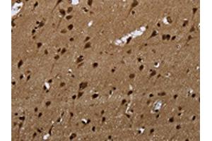 The image on the left is immunohistochemistry of paraffin-embedded Human brain tissue using ABIN7189815(ANP32E Antibody) at dilution 1/20, on the right is treated with synthetic peptide. (ANP32E 抗体)