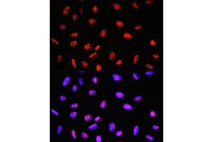 Immunofluorescence analysis of U-2 OS cells using P Rabbit mAb (ABIN7269445) at dilution of 1:100 (40x lens). (PABPN1 抗体)