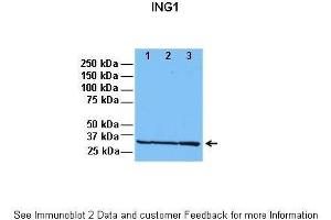 Lanes:   1: 30ug HeLa lysate, 2: 30ug HFF lysate, 3: 30ug U2OS lysate  Primary Antibody Dilution:   1:1000  Secondary Antibody:   Anti-rabbit HRP  Secondary Antibody Dilution:   1:5000  Gene Name:   ING1  Submitted by:   Dr. (ING1 抗体  (C-Term))