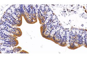 Detection of CK5 in Rat Colon Tissue using Polyclonal Antibody to Cytokeratin 5 (CK5) (Cytokeratin 5 抗体  (AA 335-473))