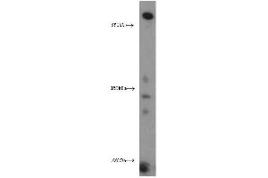 Western Blotting (WB) image for anti-Xin Actin-Binding Repeat Containing 2 (XIRP2) antibody (ABIN2906145) (XIRP2 抗体)