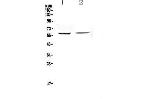 Western blot analysis of STAM1 using anti-STAM1 antibody . (STAM 抗体  (AA 9-254))