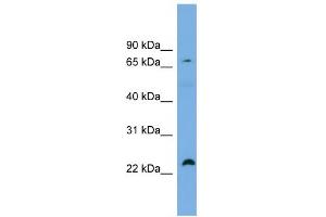 WB Suggested Anti-SPG20 Antibody Titration: 0. (SPG20 抗体  (Middle Region))