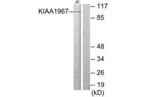 Western blot analysis of extracts from Jurkat cells, using KIAA1967 antibody. (CCAR2 抗体)