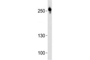 Western blot analysis of lysate from U-87 MG cell line using ROS1 antibody at 1:1000. (ROS1 抗体  (C-Term))
