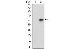 Western blot analysis using GABBR2 mAb against HEK293 (1) and GABBR2 (AA: 319-483)-hIgGFc transfected HEK293 (2) cell lysate. (GABBR2 抗体  (AA 319-483))
