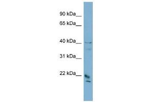 DYDC1 antibody used at 1 ug/ml to detect target protein. (DYDC1 抗体  (Middle Region))