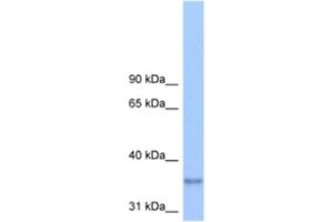 Western Blotting (WB) image for anti-Lipid Phosphate Phosphatase-Related Protein Type 2 (LPPR2) antibody (ABIN2463290) (LPPR2 抗体)