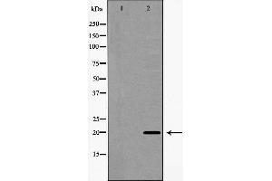 Western blot analysis of Interleukin 20 expression in A549 cells,The lane on the left is treated with the antigen-specific peptide. (IL-20 抗体  (Internal Region))