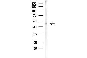 anti-Cytosolic Thiouridylase Subunit 1 Homolog (CTU1) (C-Term) antibody