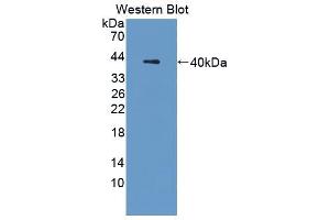 Western blot analysis of the recombinant protein. (Cathepsin L 抗体  (AA 18-113))