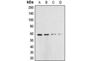 Western blot analysis of Caspase 10 expression in HeLa (A), Jurkat (B), A431 (C), K562 (D) whole cell lysates. (Caspase 10 抗体  (Center))