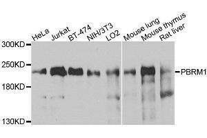 Western blot analysis of extracts of various cell lines, using PBRM1 antibody (ABIN6003610) at 1/1000 dilution. (Polybromo 1 抗体)