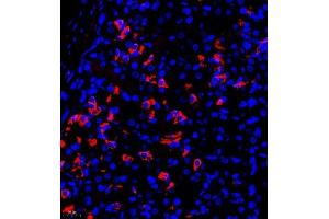 Immunofluorescence of paraffin embedded rat stomach using TR2IT1 (ABIN7075887) at dilution of 1:650 (400x lens) (TXNRD3NB 抗体)