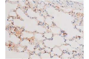 Immunohistochemistry (IHC) image for anti-Forkhead Box O4 (FOXO4) (pSer197) antibody (ABIN6255069)