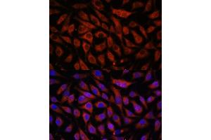 Immunofluorescence analysis of L929 cells using STK38L antibody (ABIN7270226) at dilution of 1:100. (STK38L 抗体  (AA 165-464))