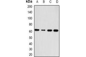 Western blot analysis of HAS3 expression in A549 (A), SKOV3 (B), mouse heart (C), rat liver (D) whole cell lysates. (HAS3 抗体)