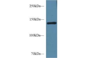 Western blot analysis of Mouse Serum, using Mouse SEMA4D Antibody (1 µg/ml) and HRP-conjugated Goat Anti-Rabbit antibody ( (SEMA4D/CD100 抗体  (AA 502-636))