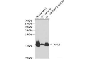 Western blot analysis of extracts of various cell lines using TNNC1 Polyclonal Antibody at dilution of 1:1000. (TNNC1 抗体)
