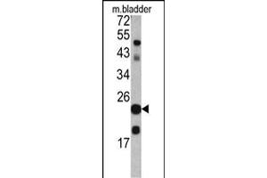 Western blot analysis of TAGLN antibody in mouse bladder tissue lysates (35ug/lane) (Transgelin 抗体  (C-Term))
