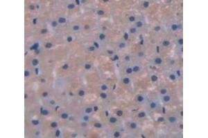 Used in DAB staining on fromalin fixed paraffin- embedded Kidney tissue (GLI1 抗体  (AA 810-1109))