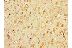 Immunohistochemistry of paraffin-embedded human placenta tissue using ABIN7176684 at dilution of 1:100 (SLC3A7 (AA 162-236) 抗体)