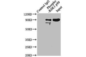 Immunoprecipitating Phospho-RPS6KA1 in Hela whole cell lysate Lane 1: Rabbit control IgG(1 μg)instead of ABIN7127744 in Hela whole cell lysate. (Recombinant RPS6KA1 抗体  (pSer363, pThr359))