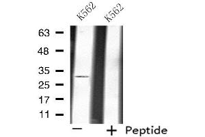 Western blot analysis of extracts from K562 cells, using ATP1B3 antibody.