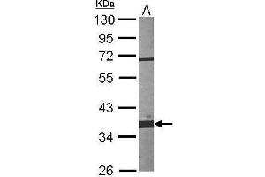 Western Blotting (WB) image for anti-Fibrillarin (FBL) antibody (ABIN2855179)