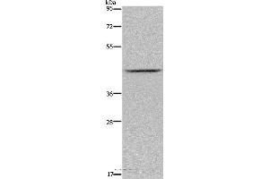 Western blot analysis of Mouse liver tissue, using JMJD6 Polyclonal Antibody at dilution of 1:800 (JMJD6 抗体)